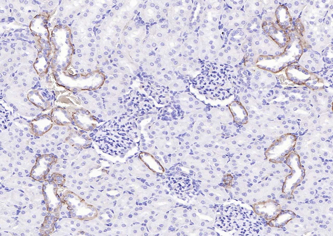 表皮生长因子受体抗体-bs-34018R