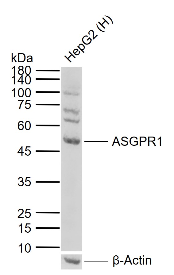 ASGPR1 Rabbit pAb (一抗) | Bioss