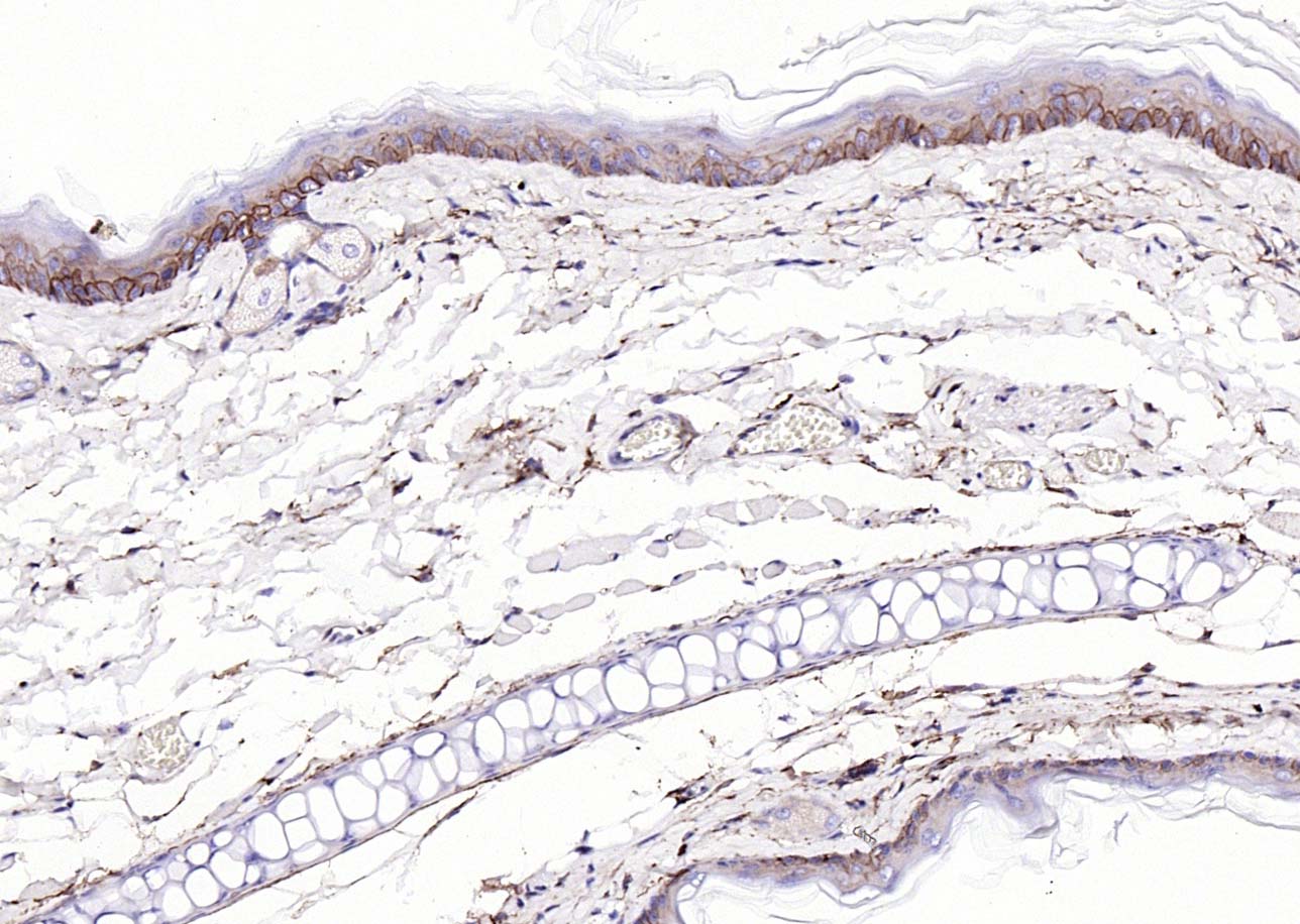 表皮生长因子受体抗体-bs-34018R