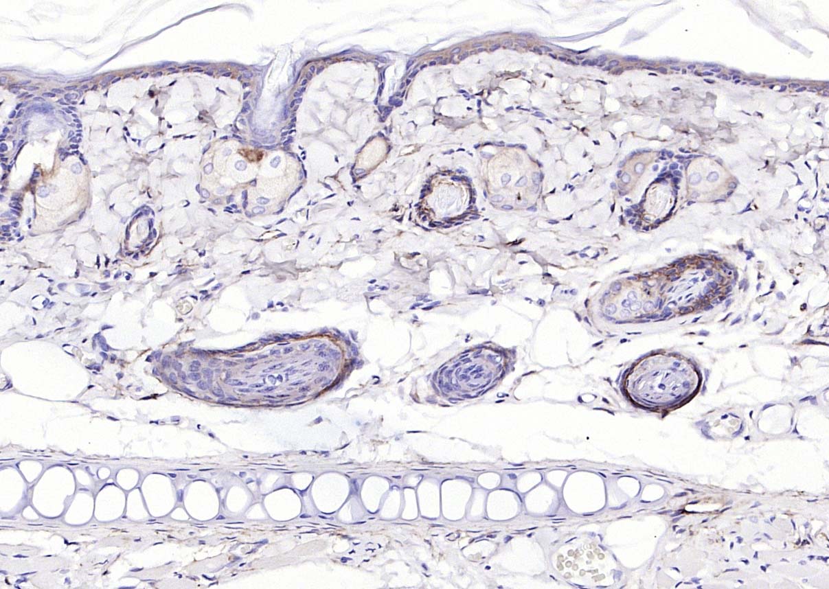 表皮生长因子受体抗体-bs-34018R