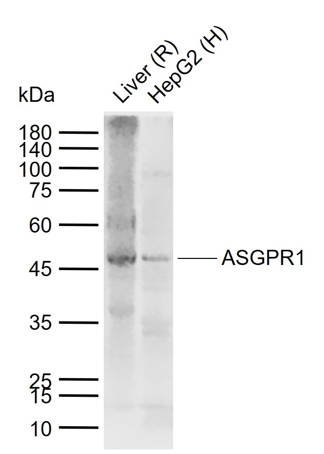 ASGPR1 Rabbit pAb (一抗) - WB | Bioss