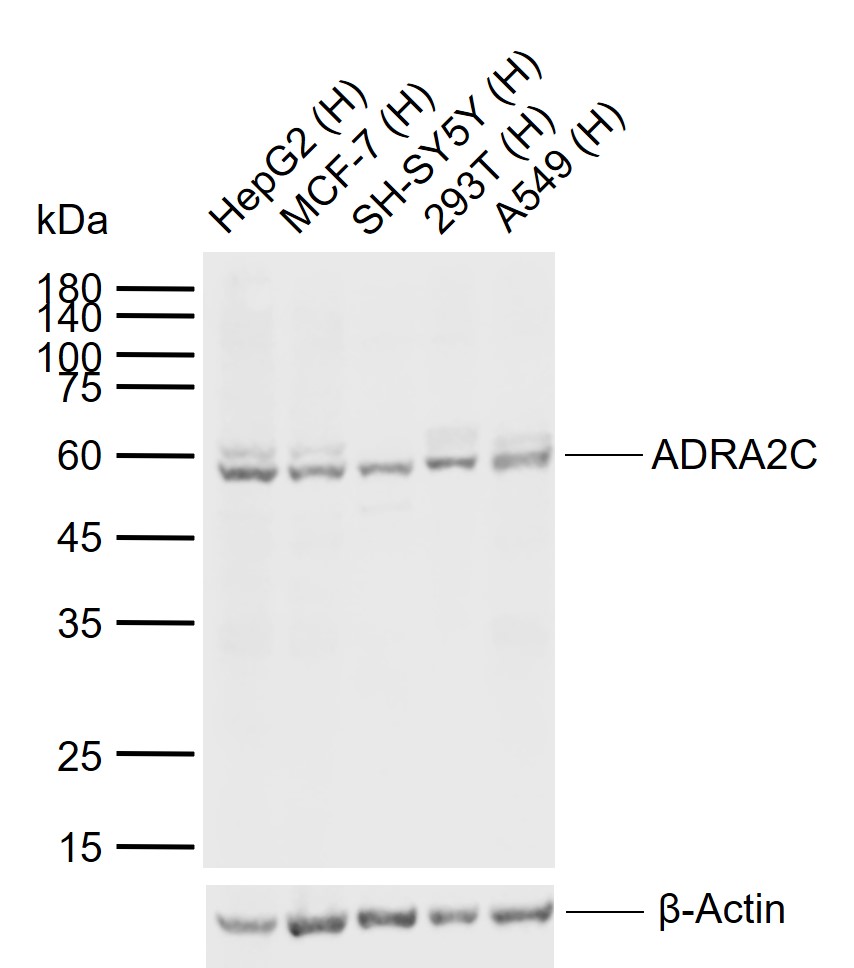 ADRA2C Rabbit pAb (一抗) | Bioss