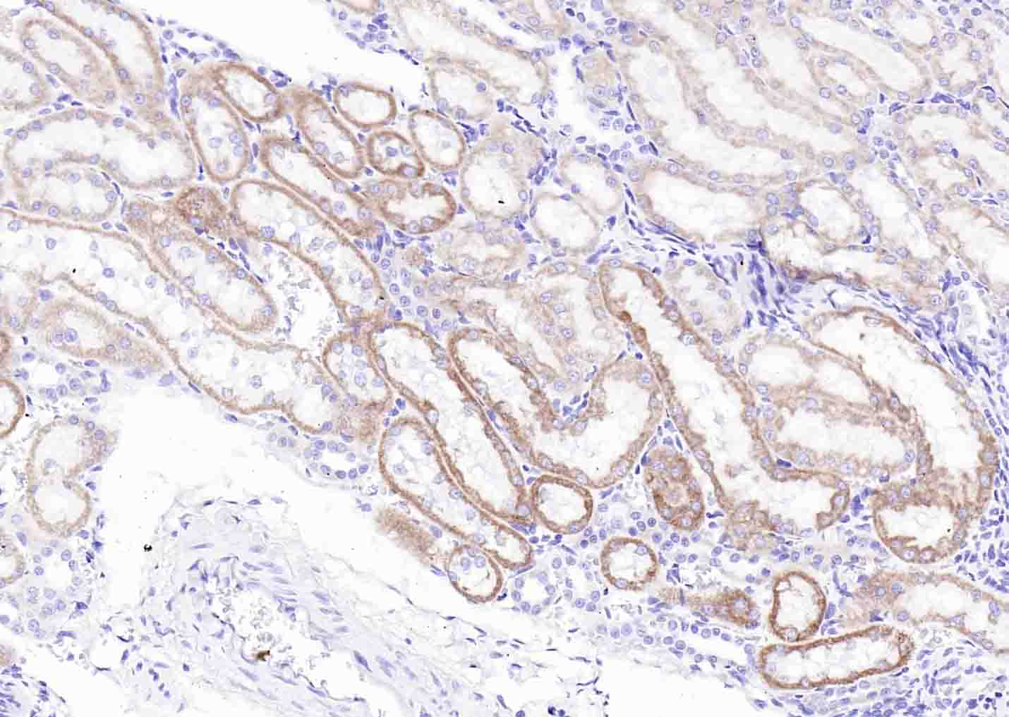 过氧化物酶-2抗体-bs-8300R
