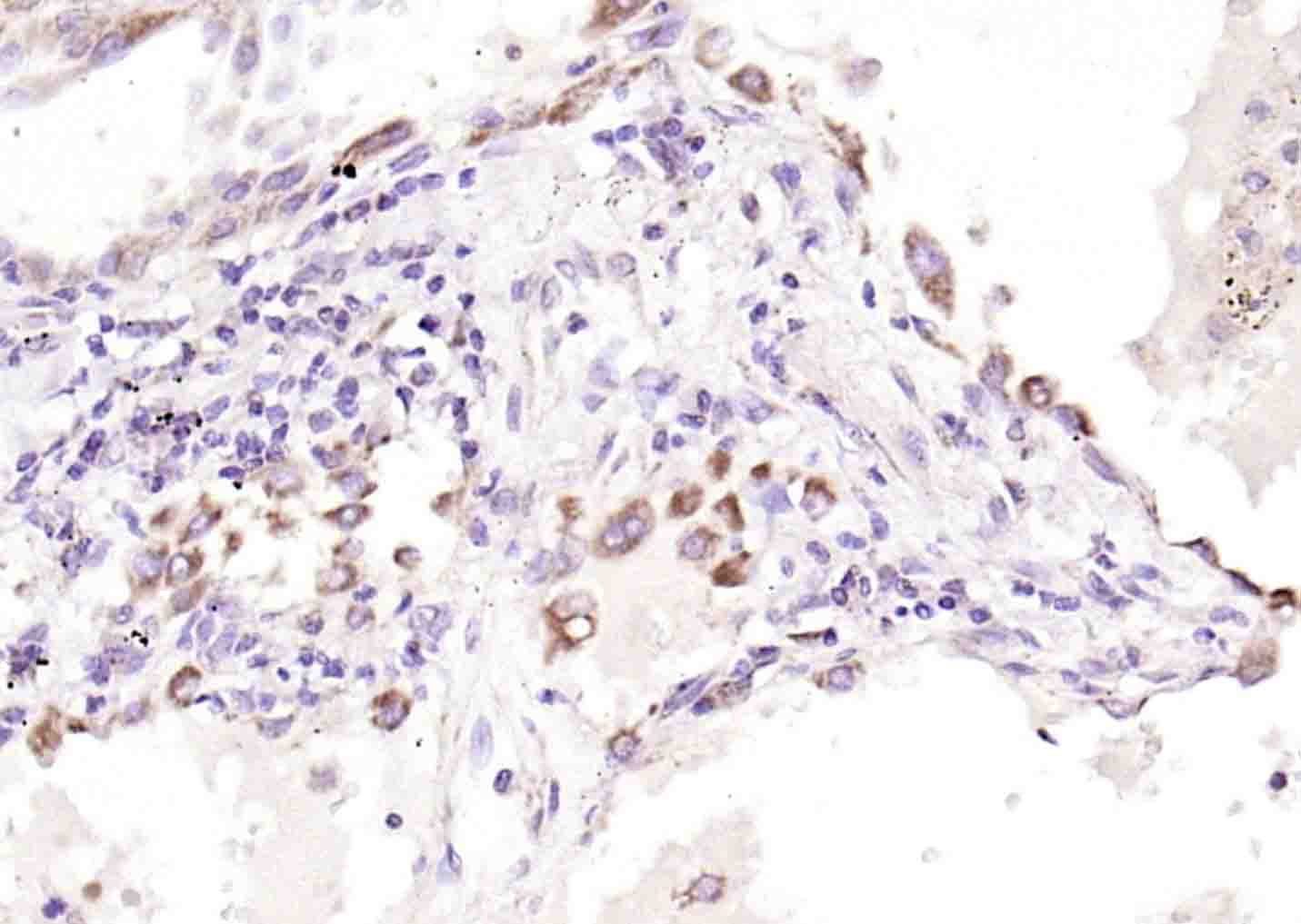 磷酸化mTOR相关调控蛋白抗体-bs-3381R