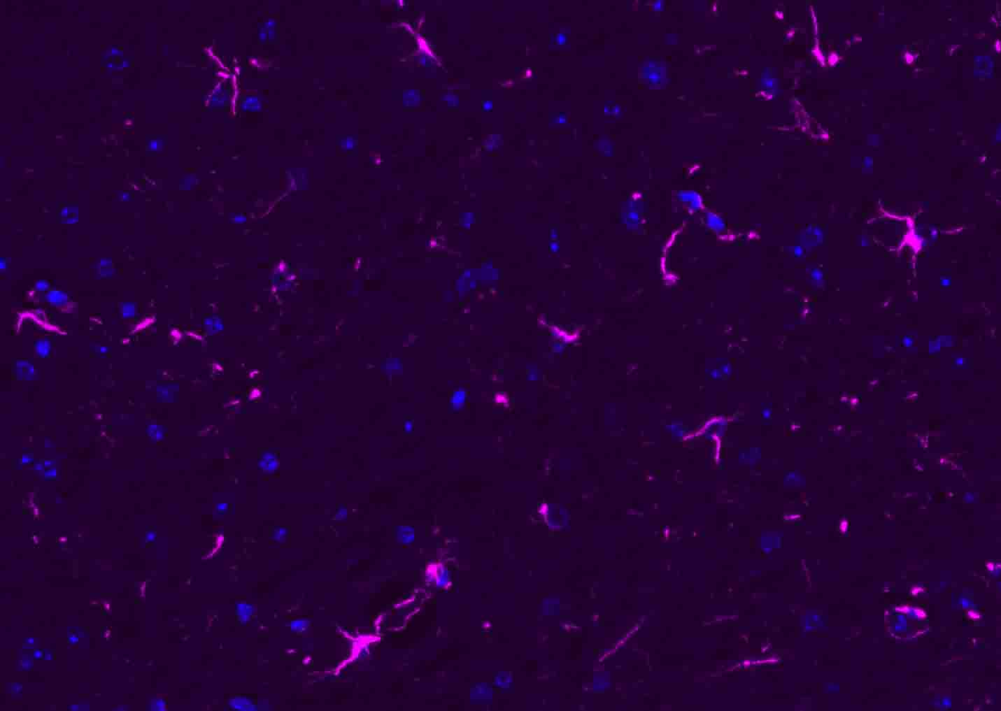 BF647标记的驴抗兔IgG H&L