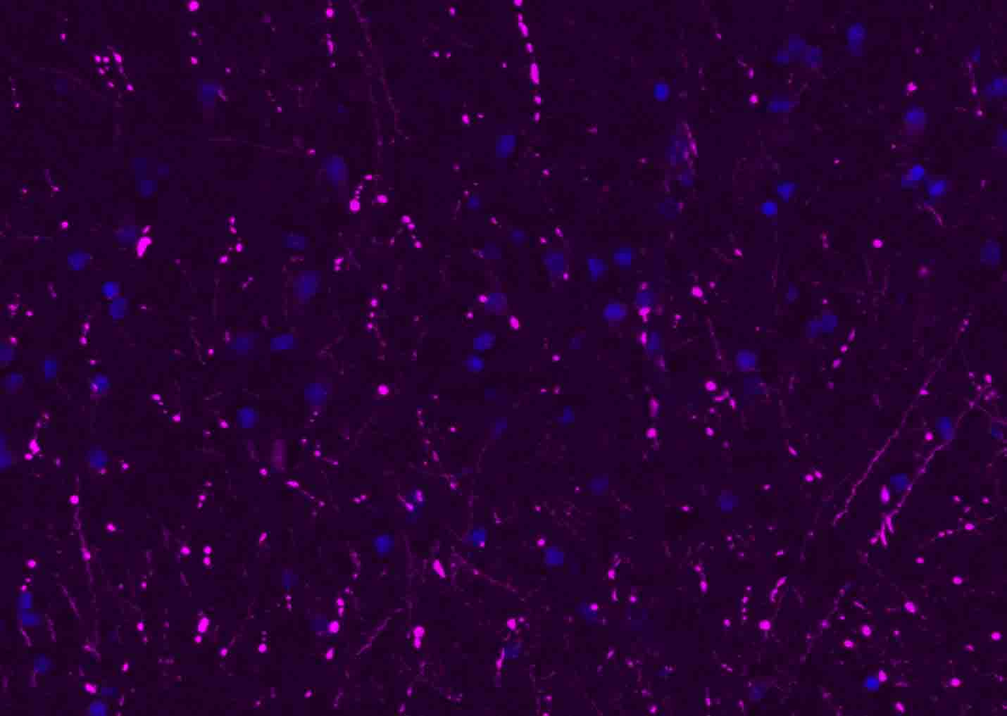 BF647标记的驴抗兔IgG H&L