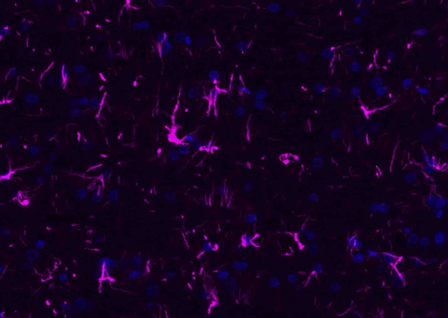 BF647标记的驴抗兔IgG H&L