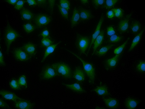 phospho-Cdc6 (Ser54) Rabbit pAb (一抗) | Bioss