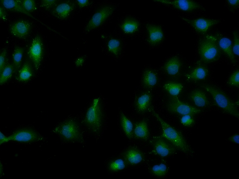 NADPH氧化酶4抗体-bs-4730R