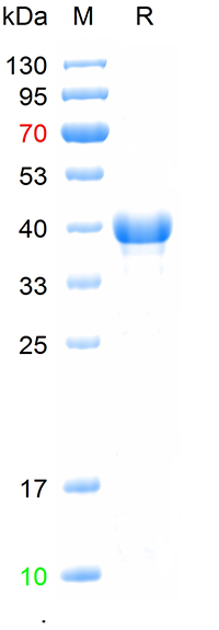 Recombinant  EV71 VP1 protein, N-His (重组蛋白) | Bioss
