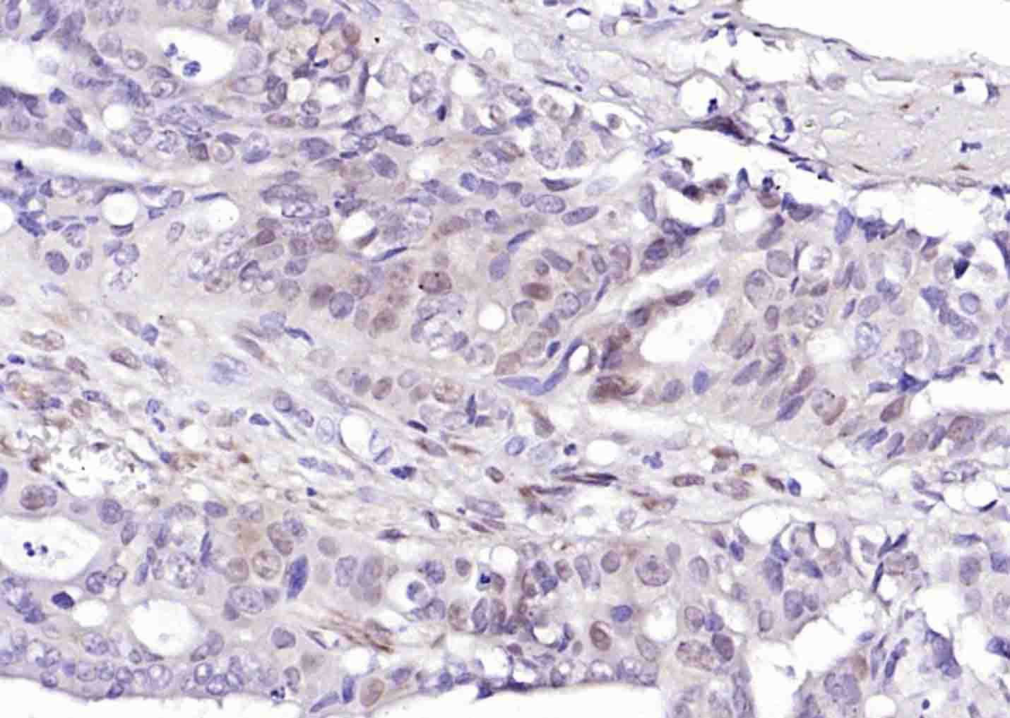 磷酸化热休克因子1重组兔单抗
