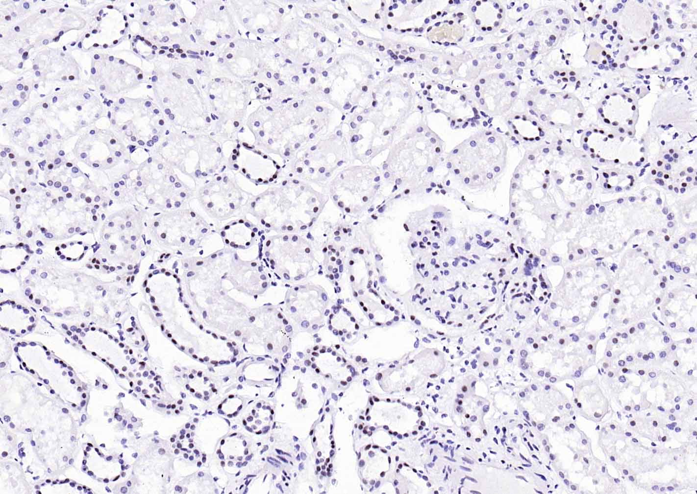 异染色质蛋白1-α单克隆抗体-bsm-33377M