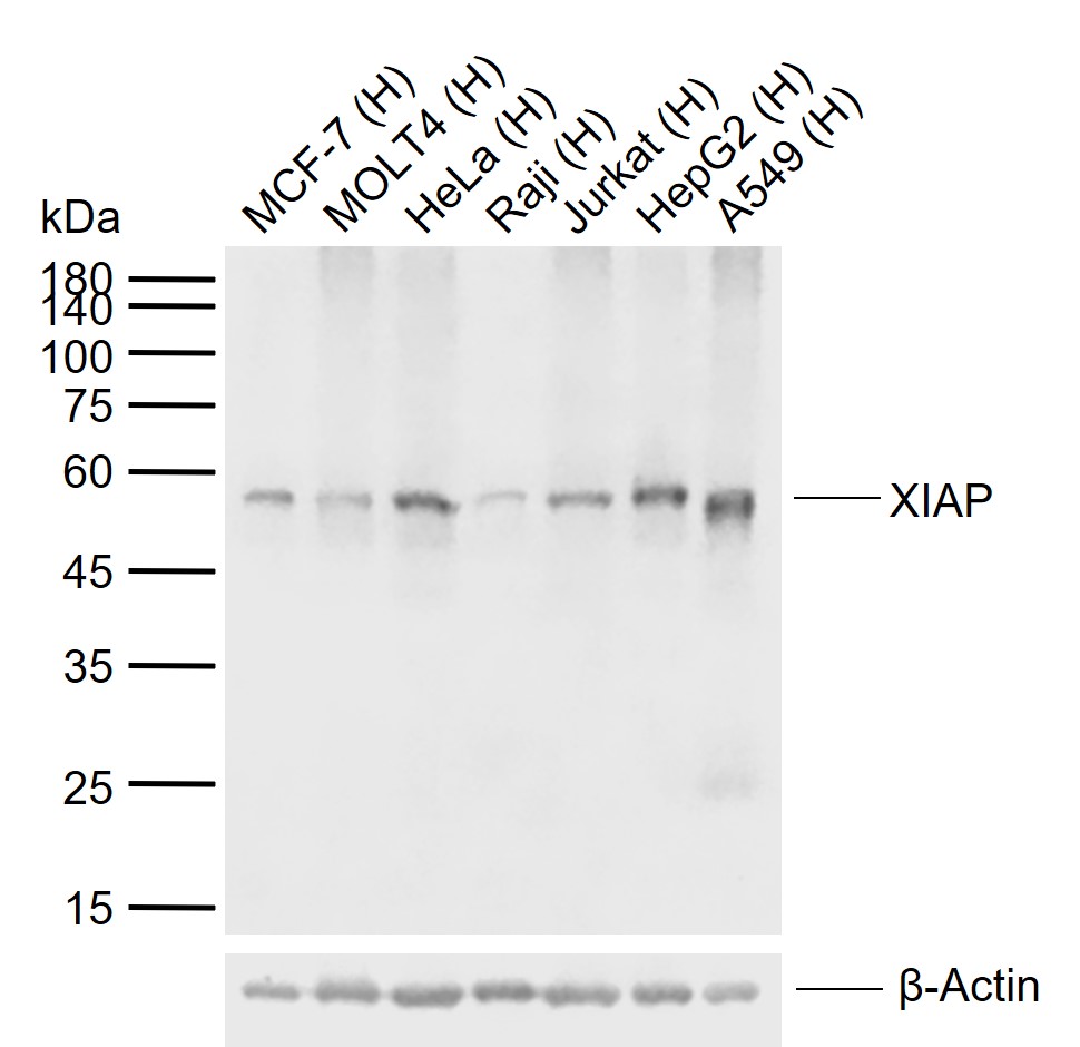 X-连锁凋亡蛋白/性连锁凋亡抑制蛋白单克隆抗体-bsm-51607M