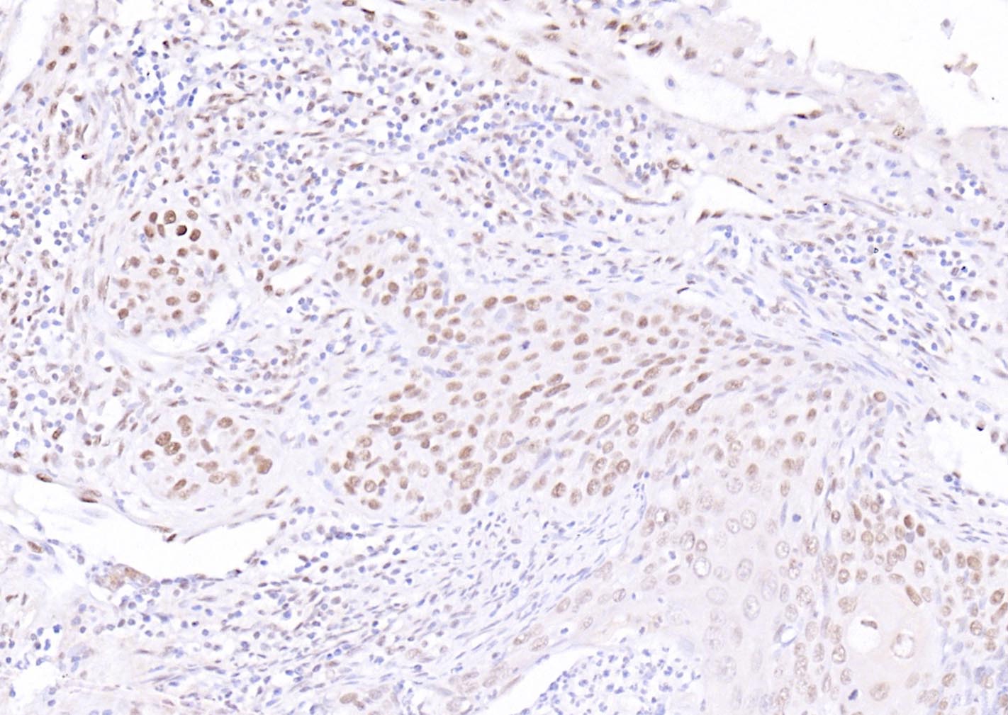 活化转录因子4抗体-bs-1531R