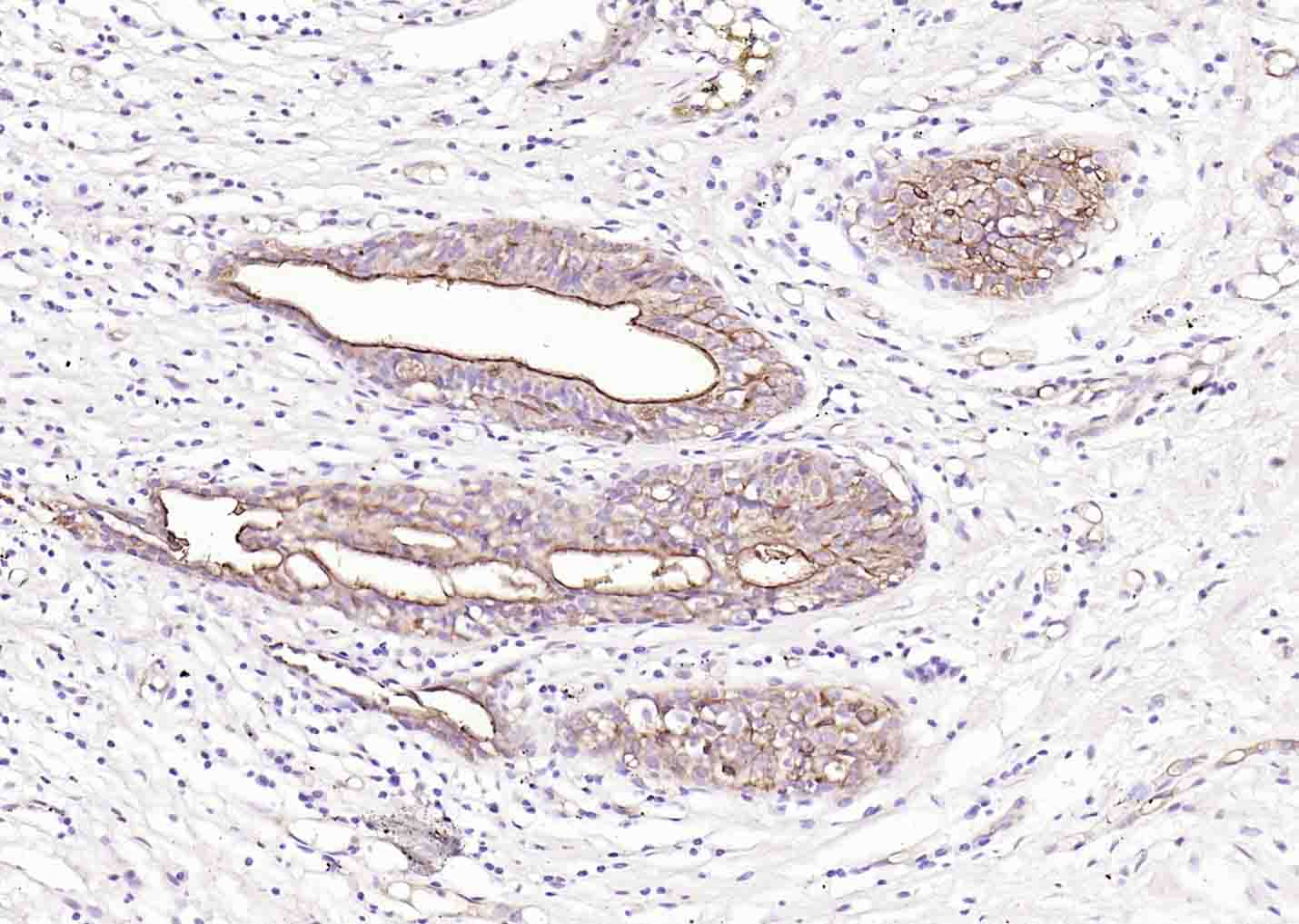 RIPK1 Rabbit pAb (一抗) | Bioss