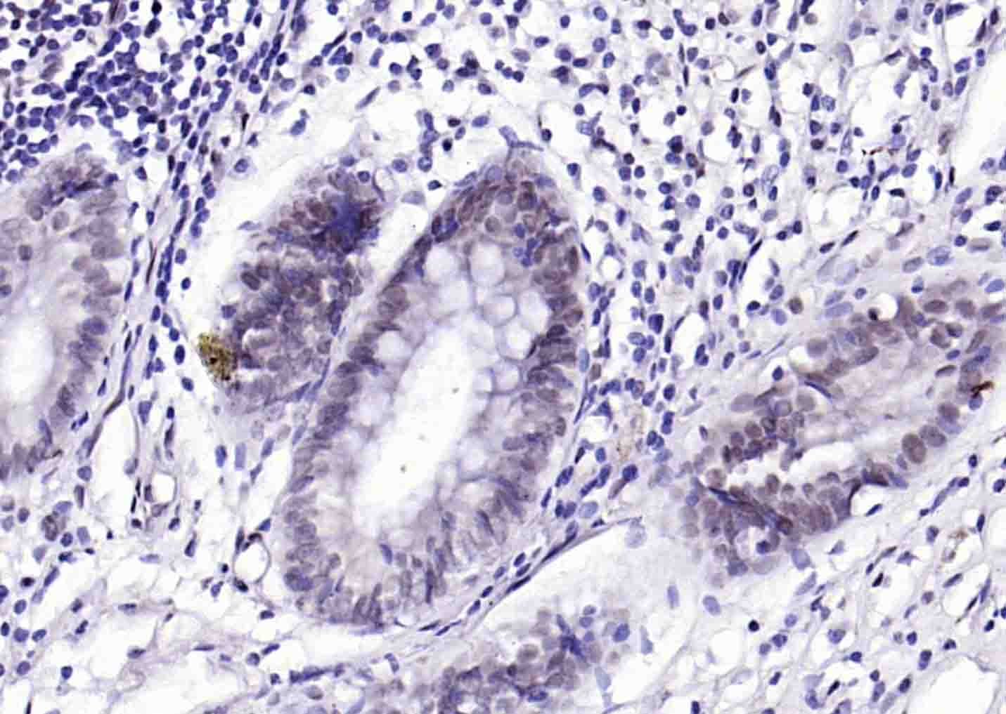 prox1 Rabbit pAb (一抗) | Bioss