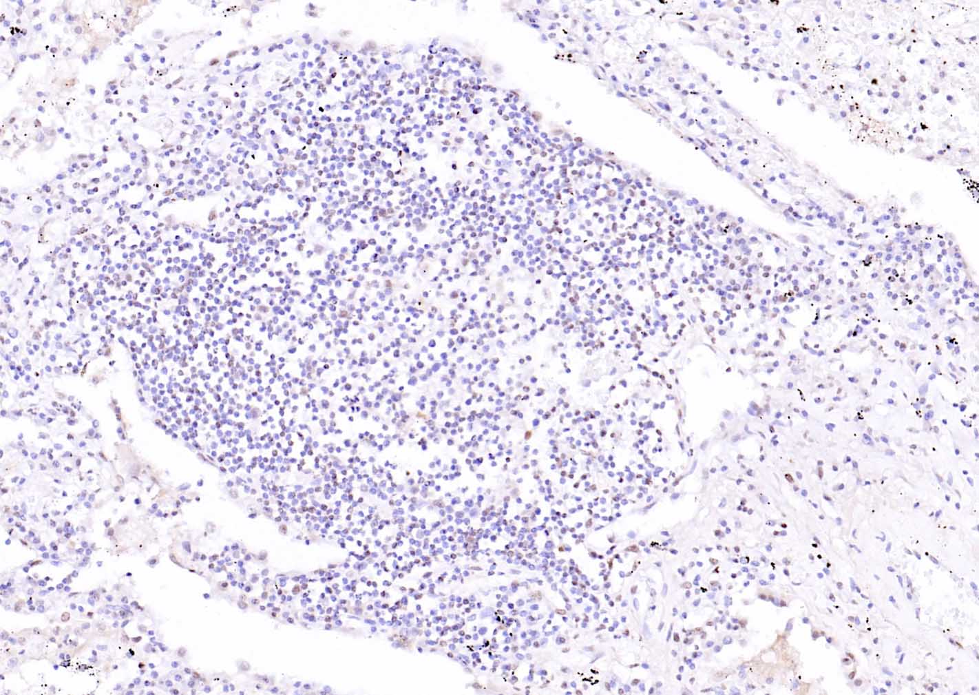 活化转录因子4抗体-bs-1531R