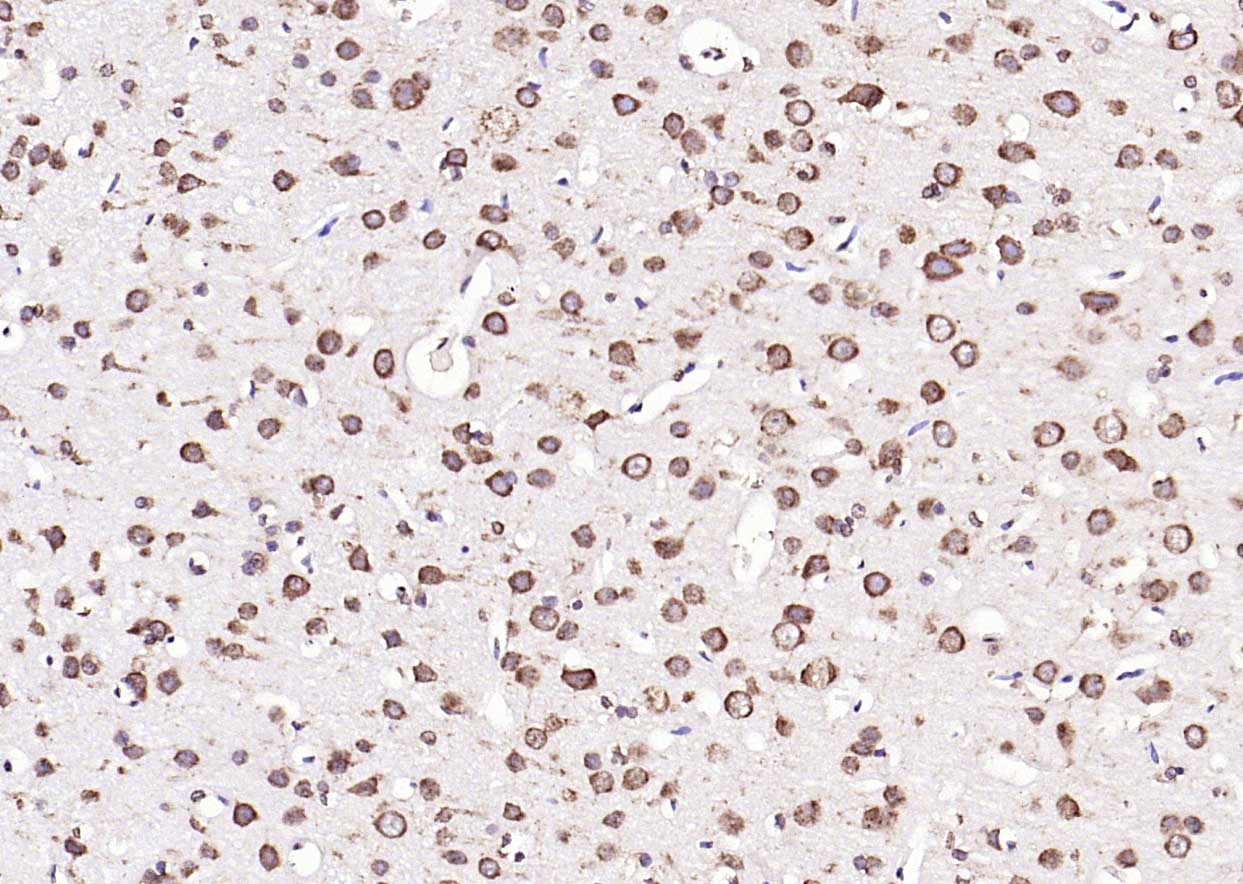 钙网蛋白单克隆抗体-bsm-51748M