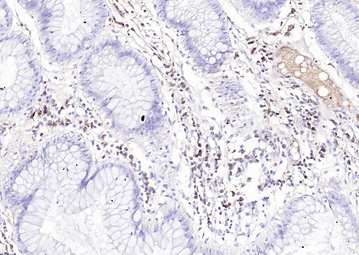 兔抗人IgG-Fc段抗体