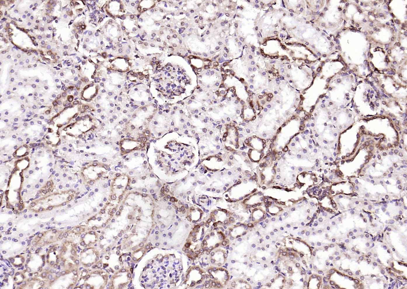 钙网蛋白单克隆抗体-bsm-51748M