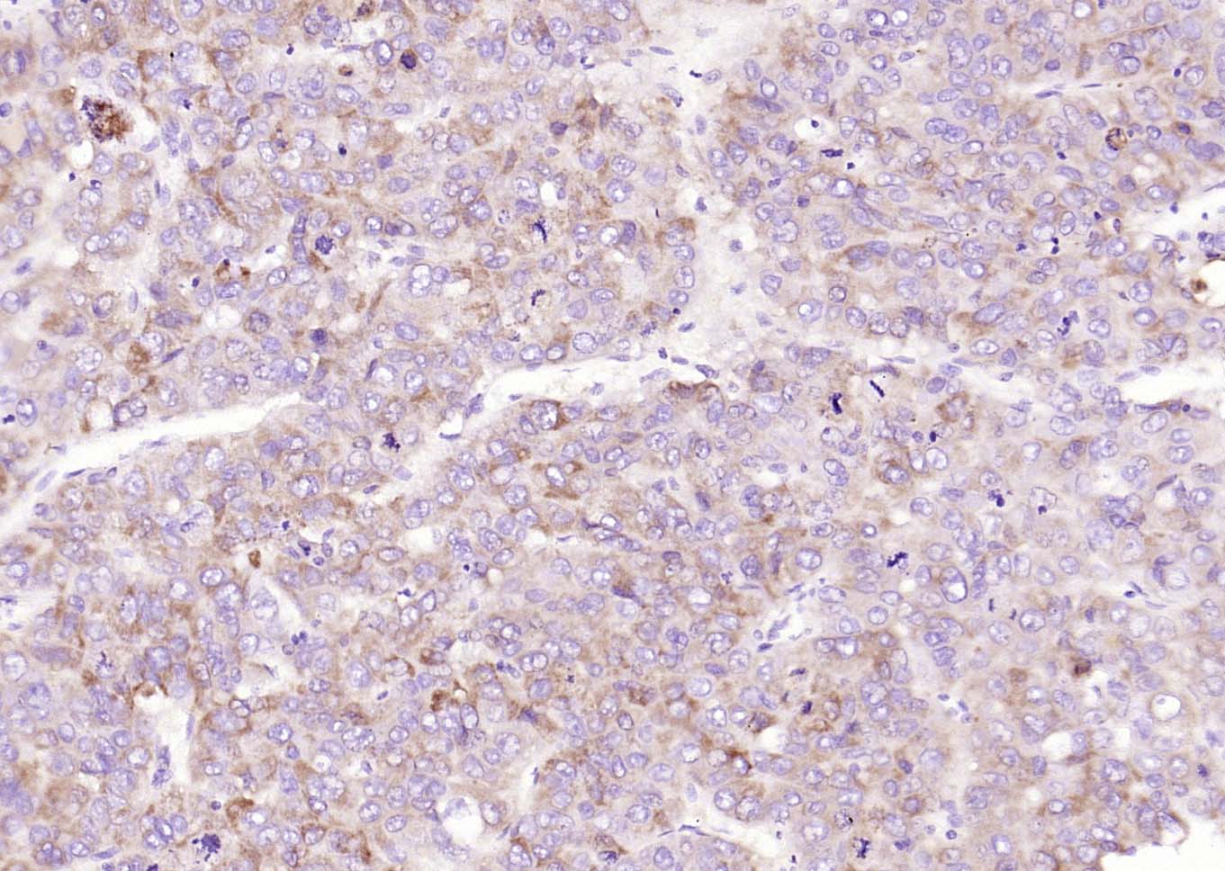 可溶性血管内皮生长因子受体1抗体-bs-41611R