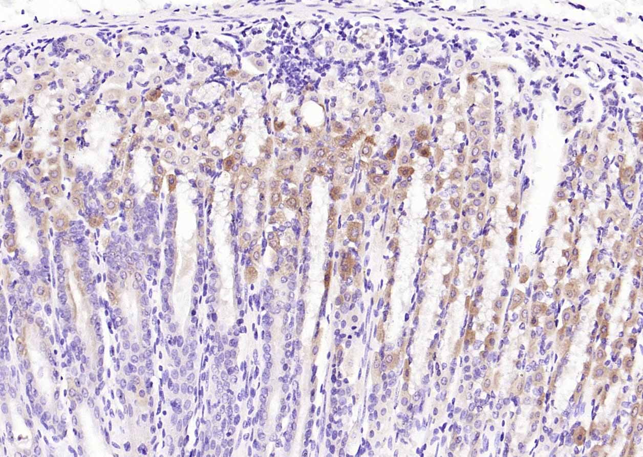 磷酸化细胞信号转导分子SMAD7抗体-bs-20024R