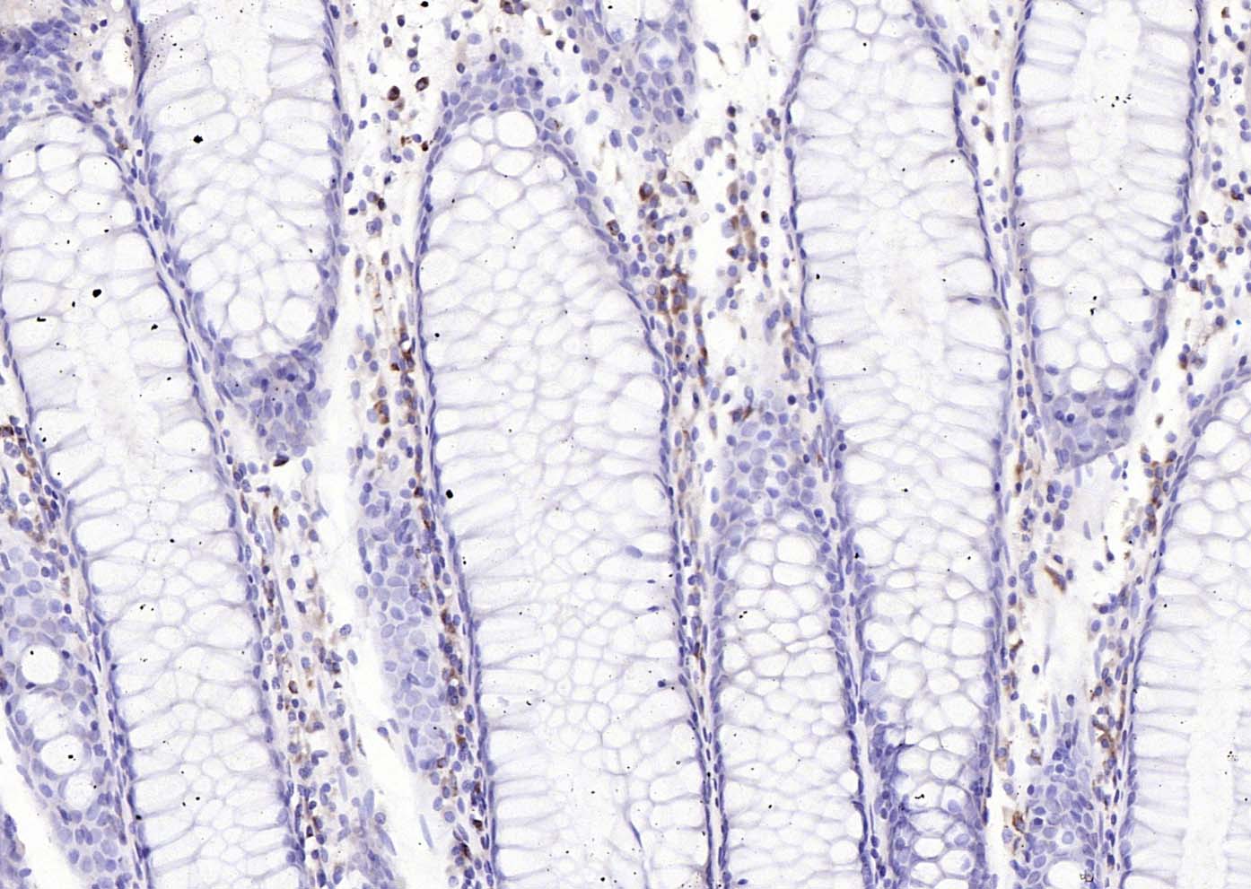 兔抗人IgG-Fc段抗体