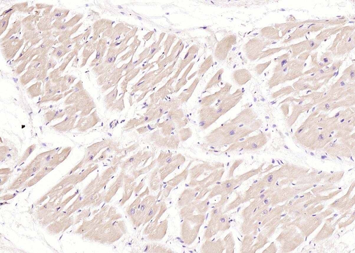 磷酸化结蛋白抗体-bs-5302R