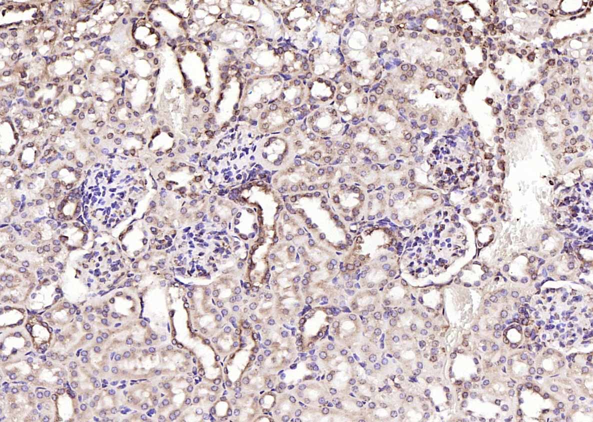 钙网蛋白单克隆抗体-bsm-51748M