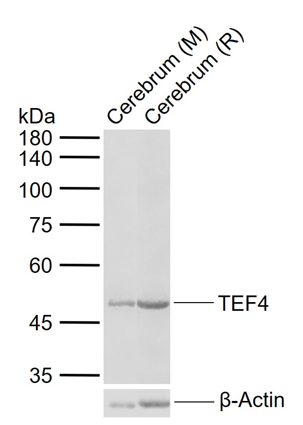 TEF4 Rabbit pAb (一抗) | Bioss