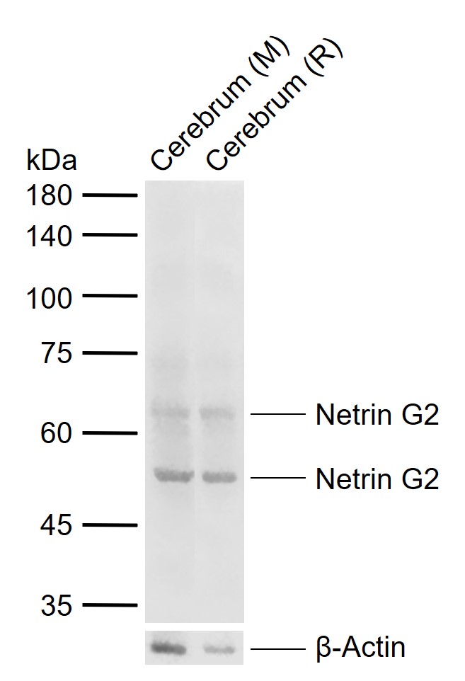 Netrin G2 Rabbit pAb (一抗) | Bioss