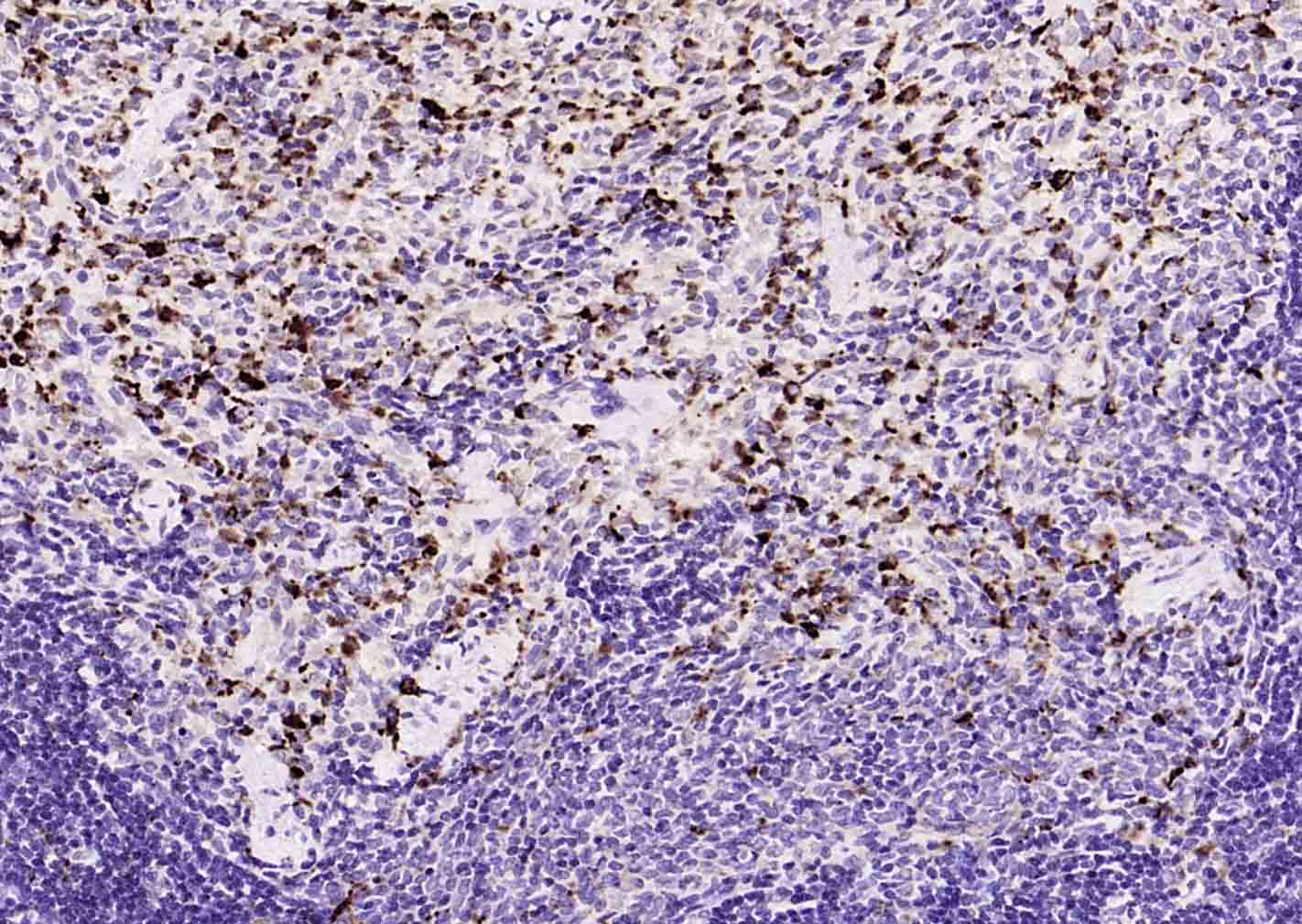 CD68单克隆抗体-bsm-33056M