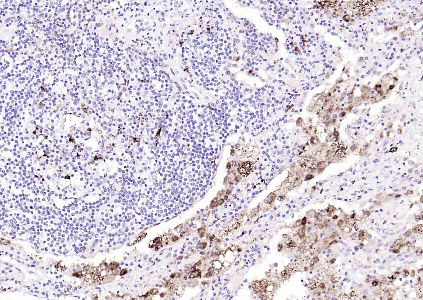 CD68单克隆抗体-bsm-33056M