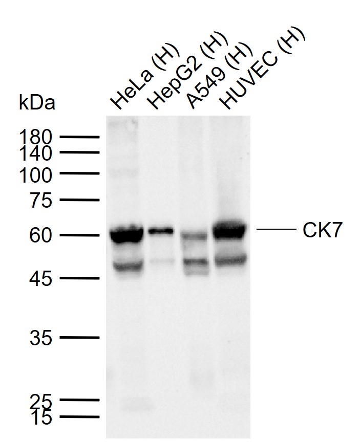 CK7 Mouse mAb (一抗) | Bioss
