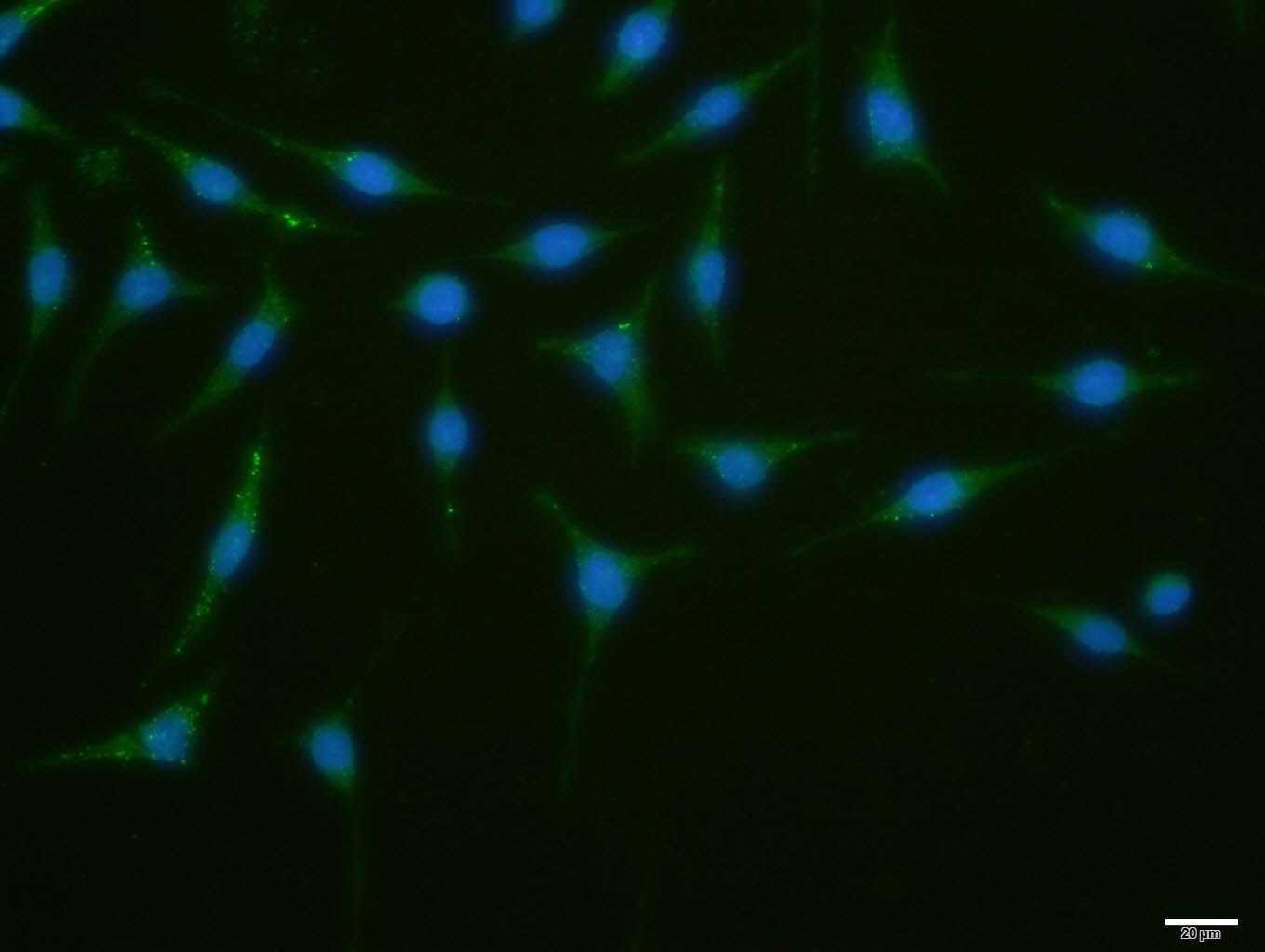 自噬相关蛋白1抗体-bs-3602R