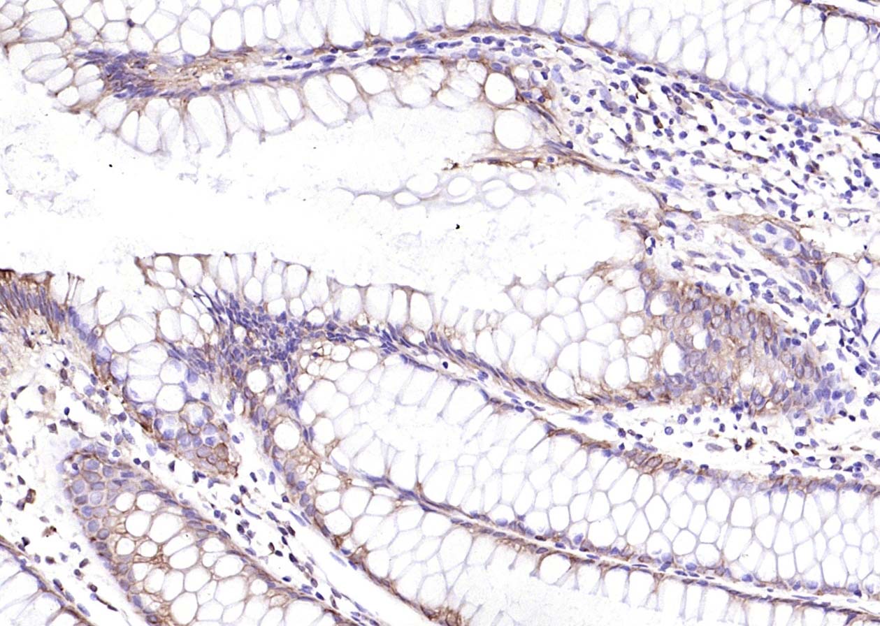 细胞角蛋白8抗体-bs-1106R