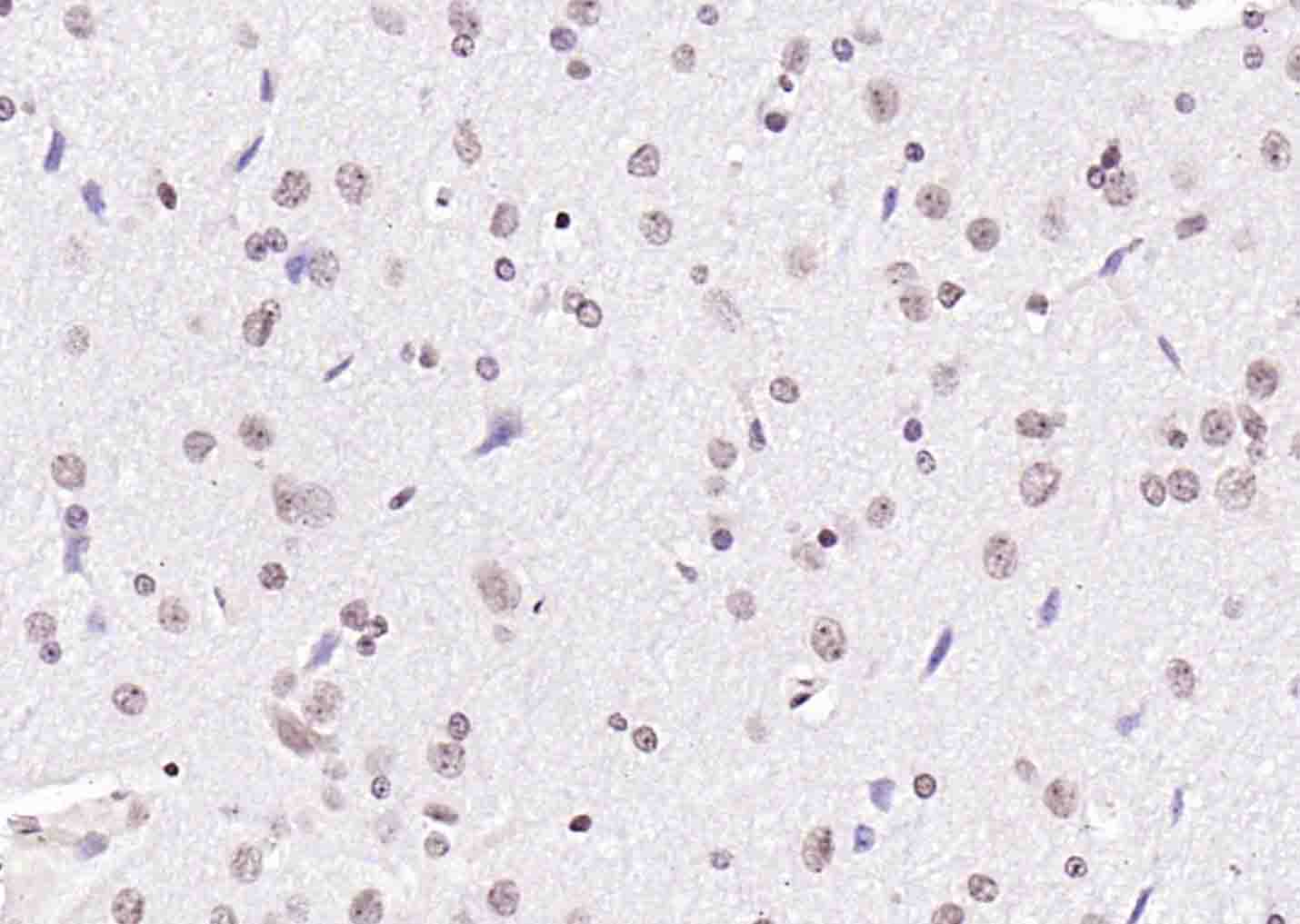 磷酸化丝氨酸/苏氨酸蛋白激酶抗体-bs-3248R