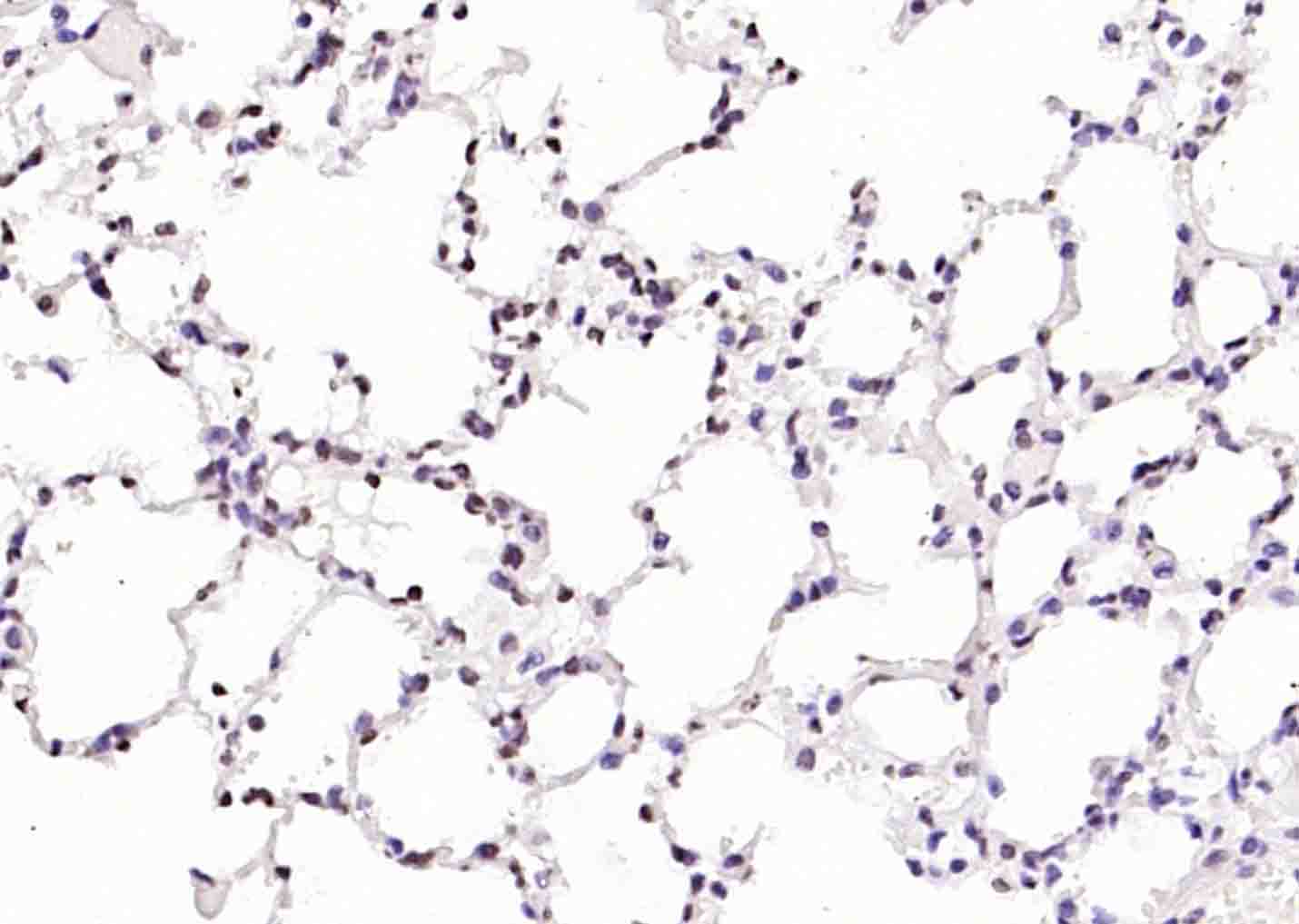 磷酸化丝氨酸/苏氨酸蛋白激酶抗体-bs-3248R