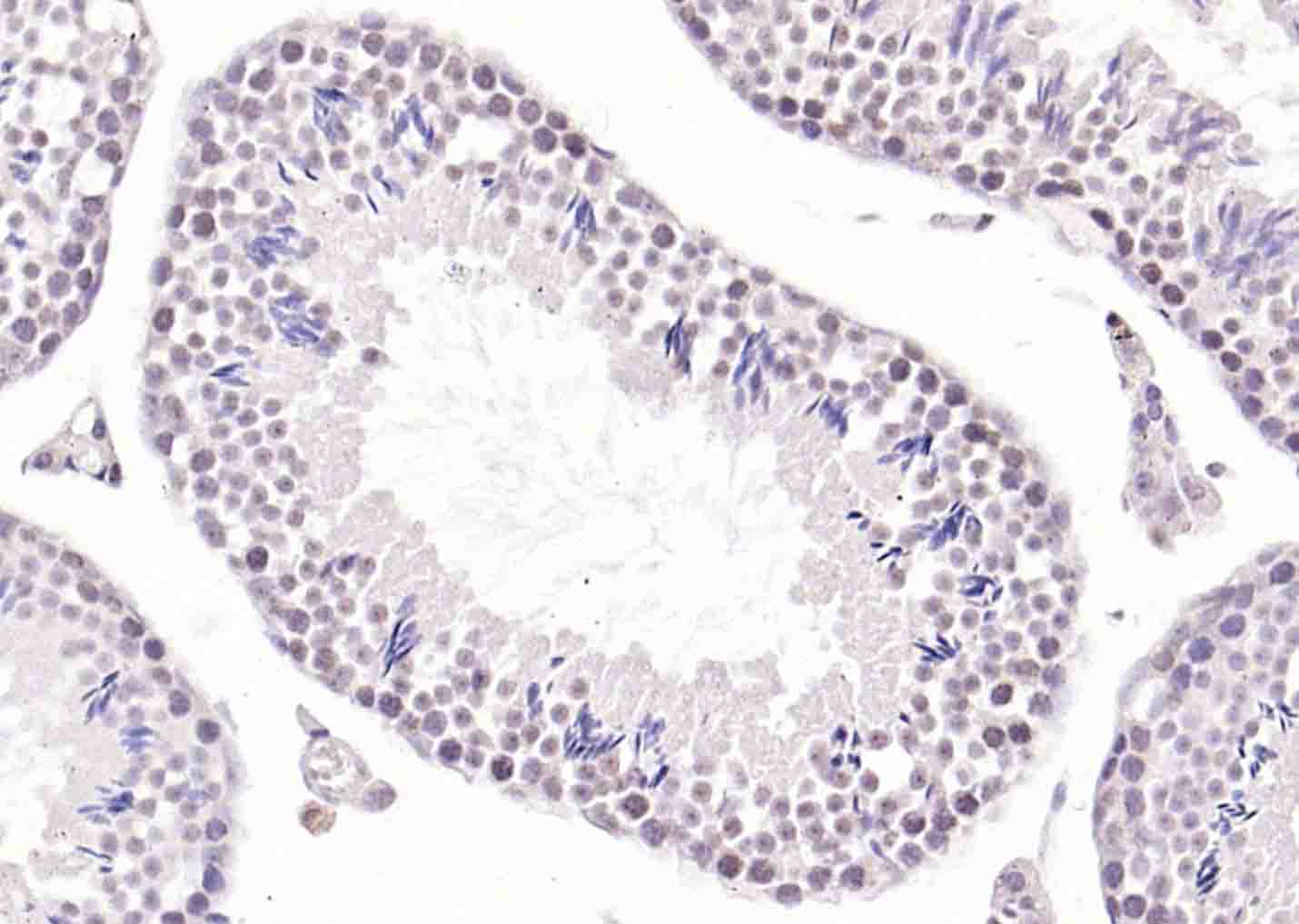 磷酸化丝氨酸/苏氨酸蛋白激酶抗体-bs-3248R