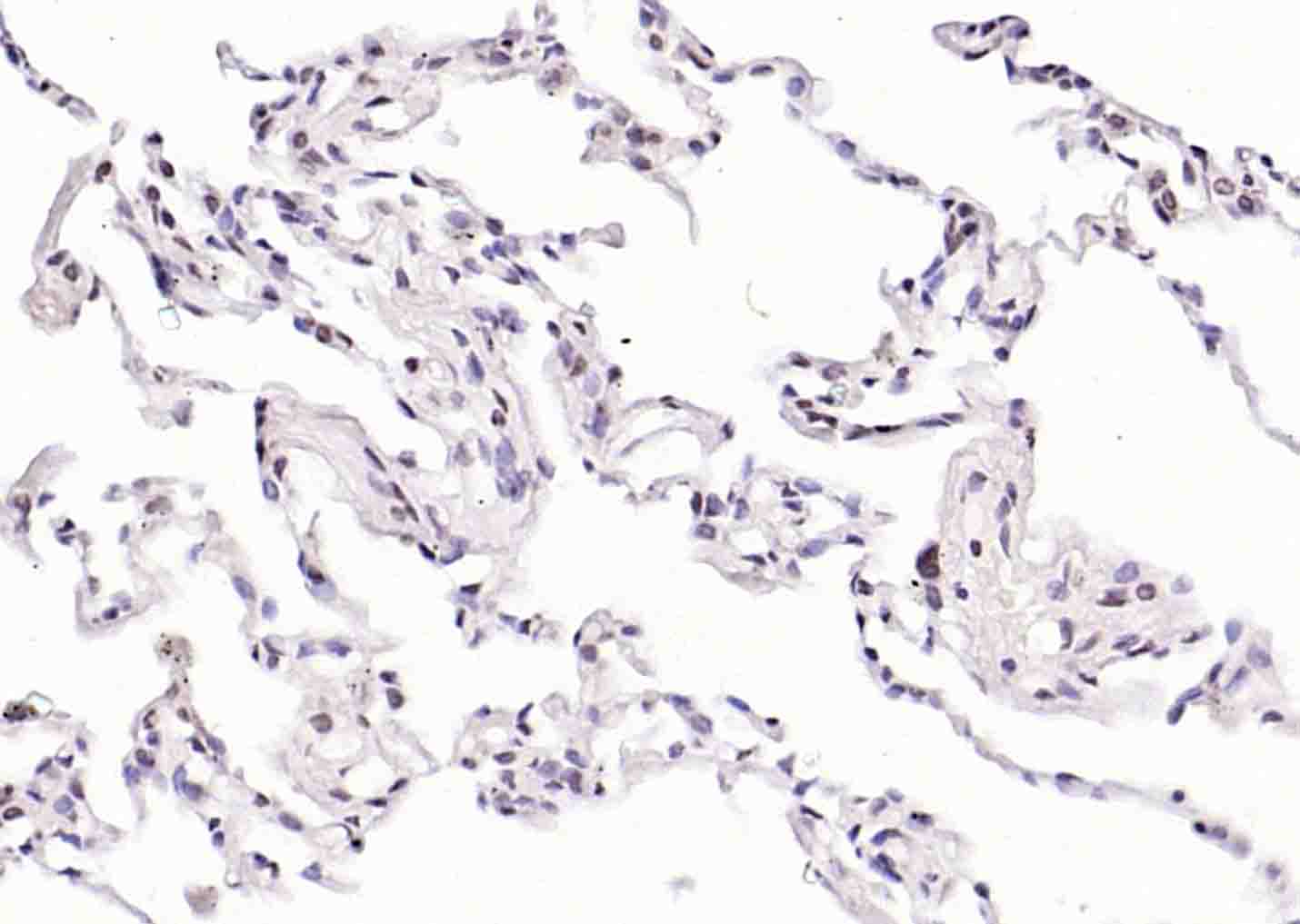 磷酸化丝氨酸/苏氨酸蛋白激酶抗体-bs-3248R