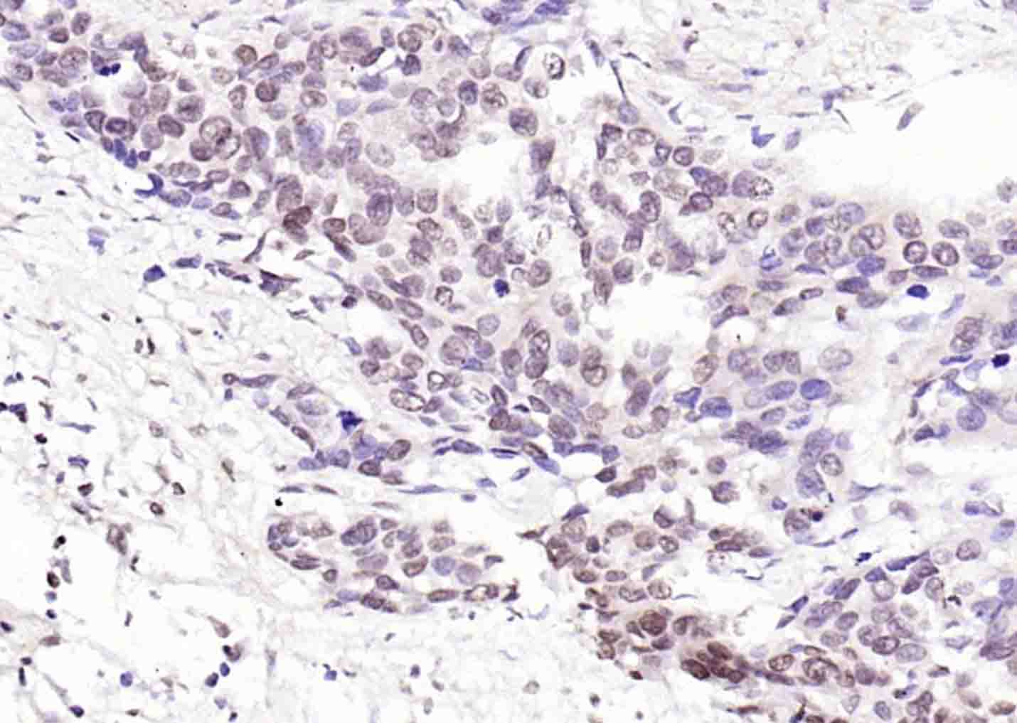 磷酸化丝氨酸/苏氨酸蛋白激酶抗体-bs-3248R