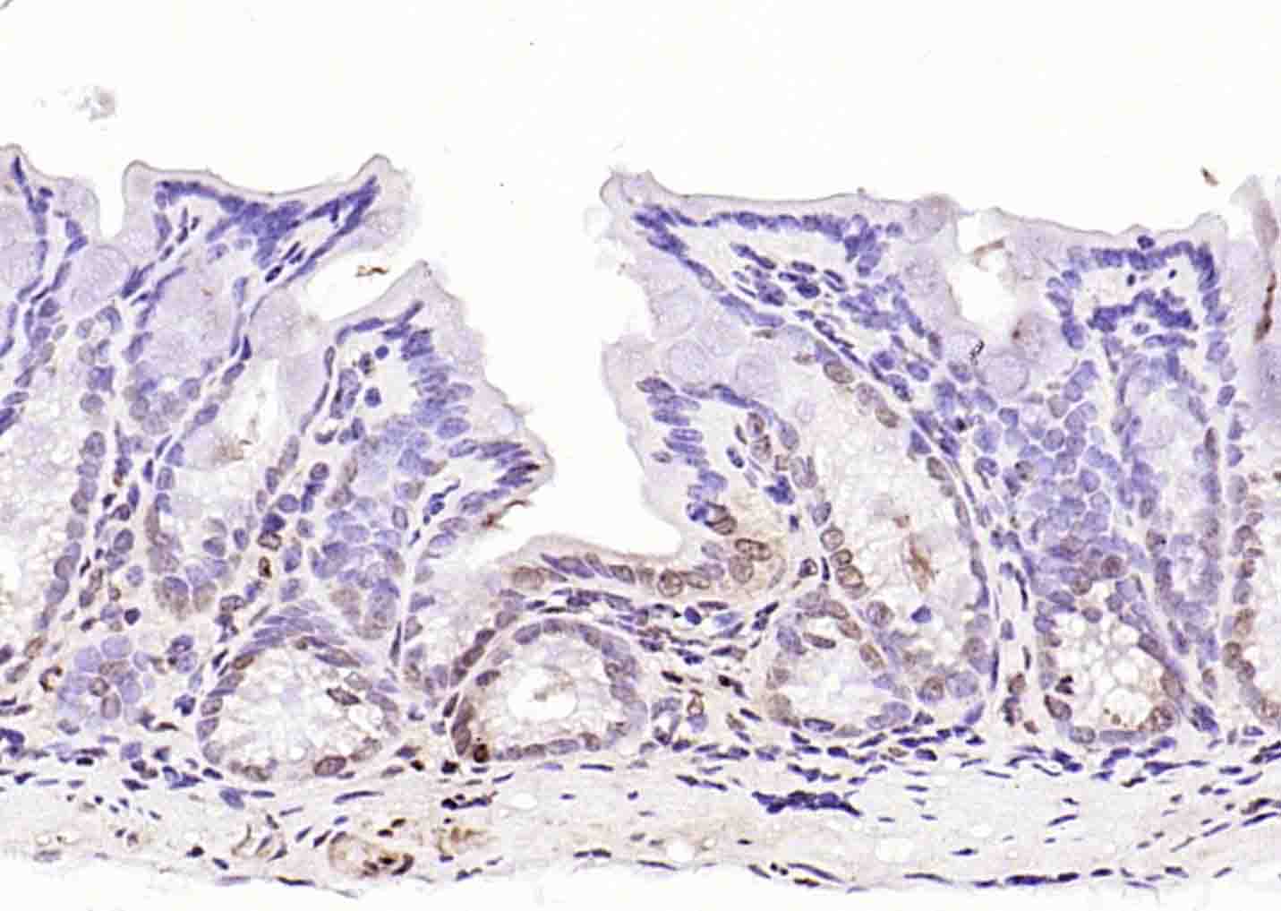 磷酸化丝氨酸/苏氨酸蛋白激酶抗体-bs-3249R