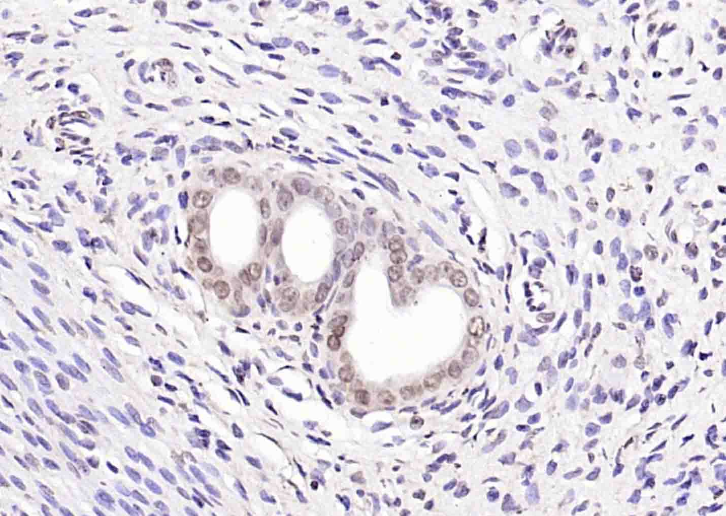 磷酸化丝氨酸/苏氨酸蛋白激酶抗体-bs-3248R