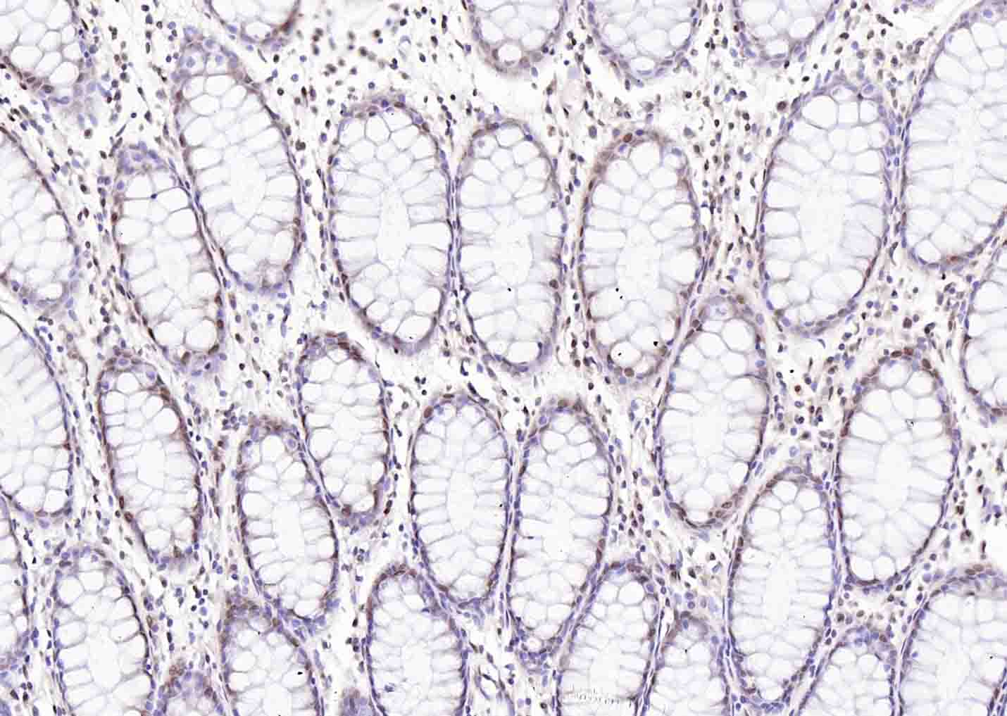 磷酸化丝氨酸/苏氨酸蛋白激酶抗体-bs-3249R