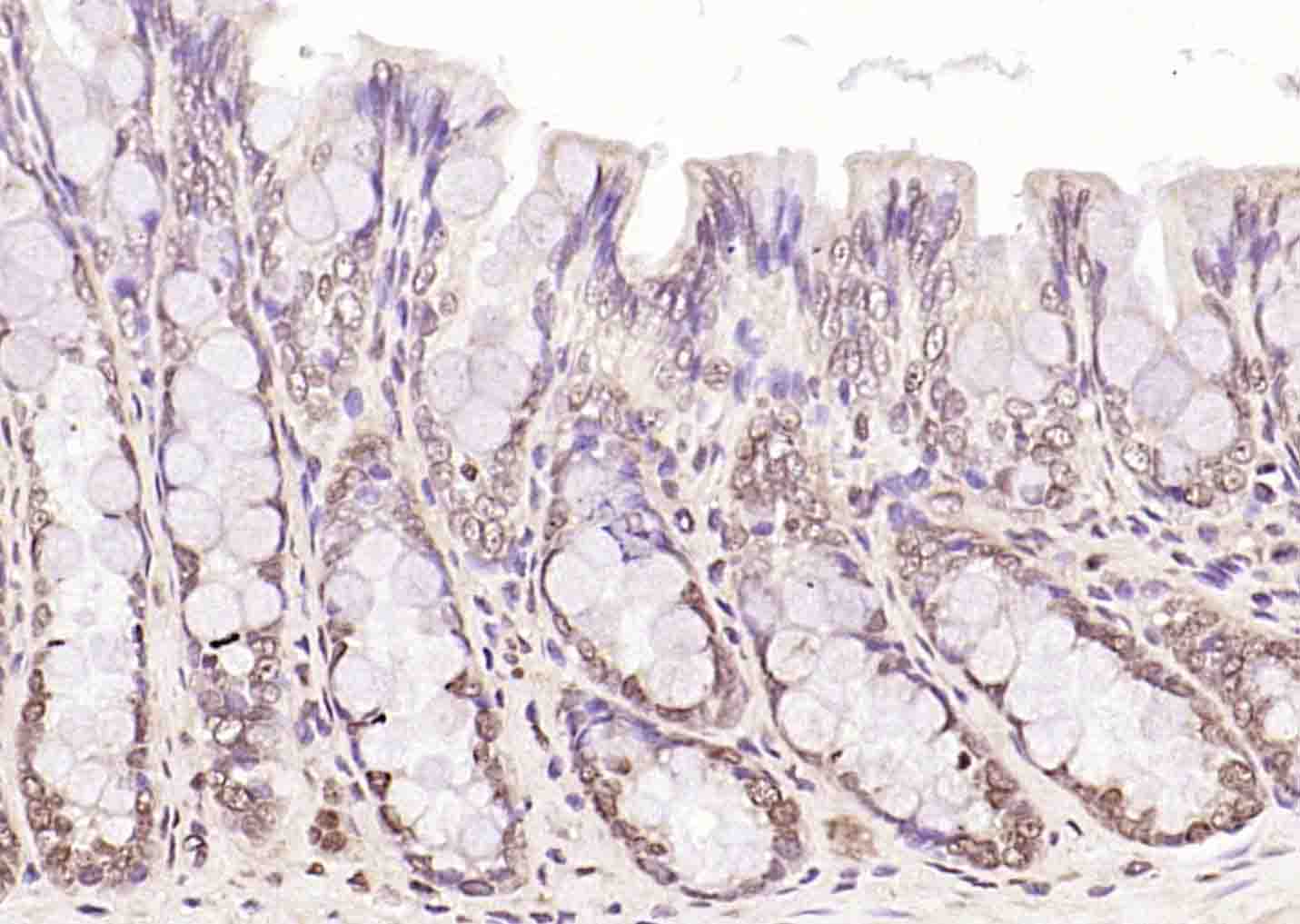 磷酸化丝氨酸/苏氨酸蛋白激酶抗体-bs-3249R