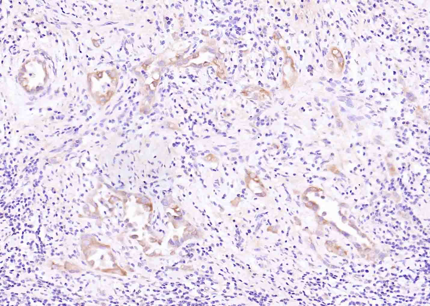 丝氨酸苏氨酸激酶1受体相互作用蛋白抗体-bs-5805R