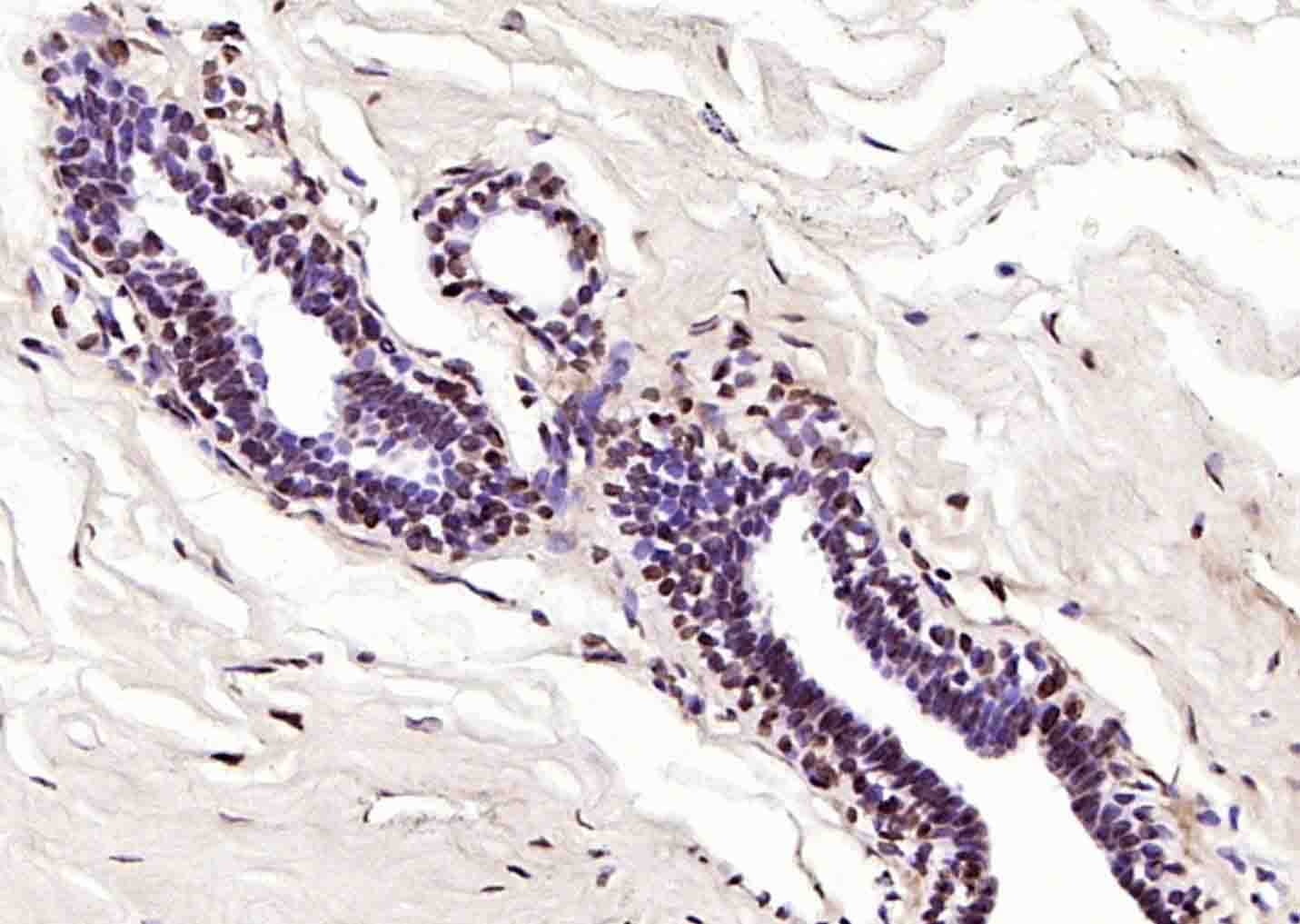 磷酸化丝氨酸/苏氨酸蛋白激酶抗体-bs-3248R