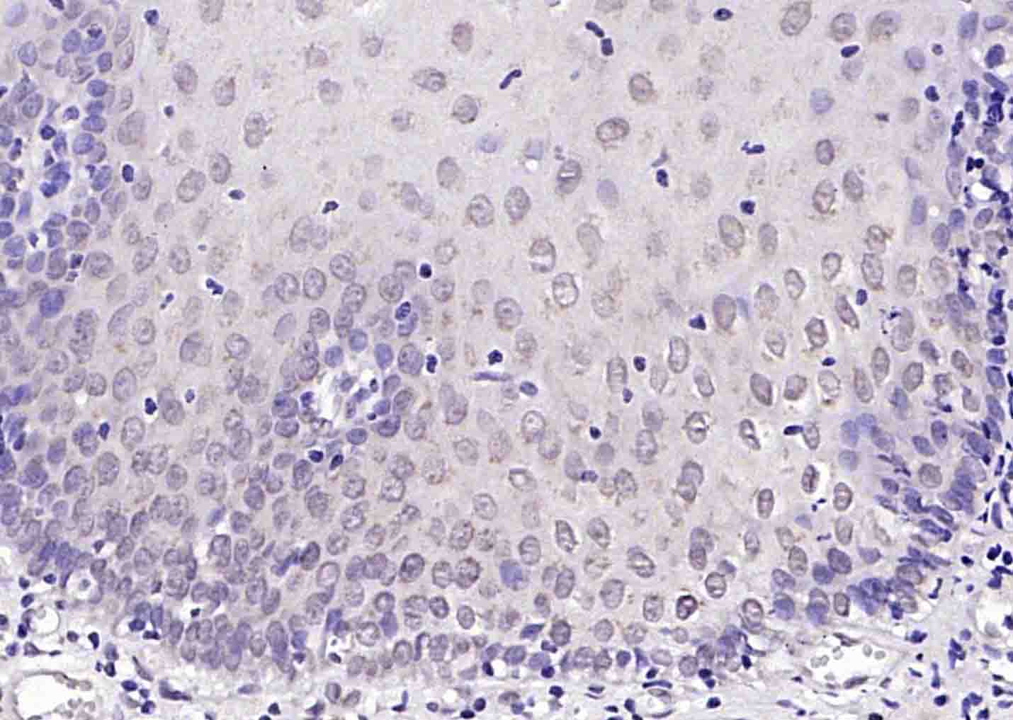 磷酸化细胞肿瘤抗原P53抗体-bs-1650R