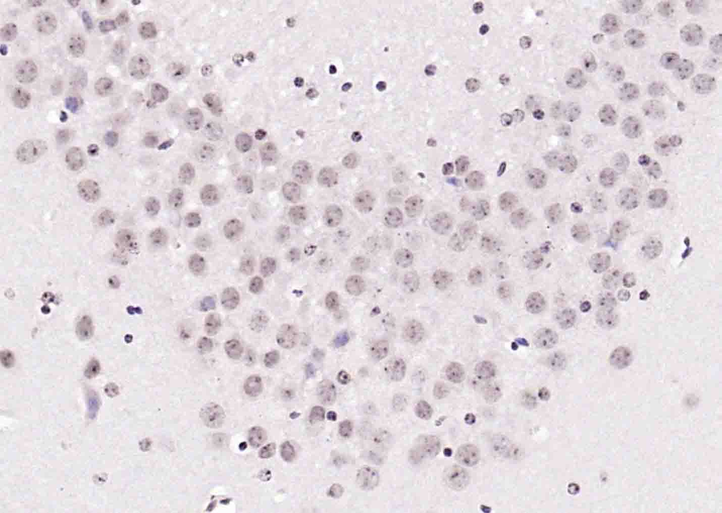 磷酸化丝氨酸/苏氨酸蛋白激酶抗体-bs-3248R