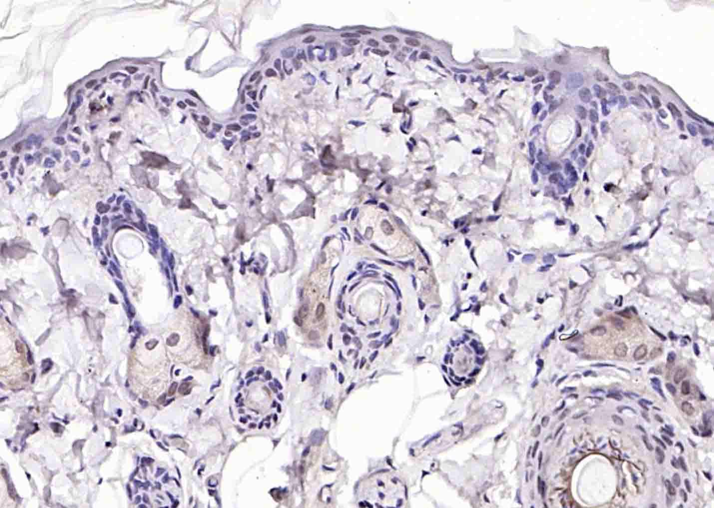 磷酸化细胞肿瘤抗原P53抗体-bs-1650R